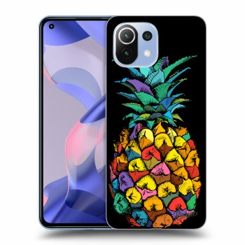 Picasee ULTIMATE CASE pro Xiaomi 11 Lite 5G NE - Pineapple