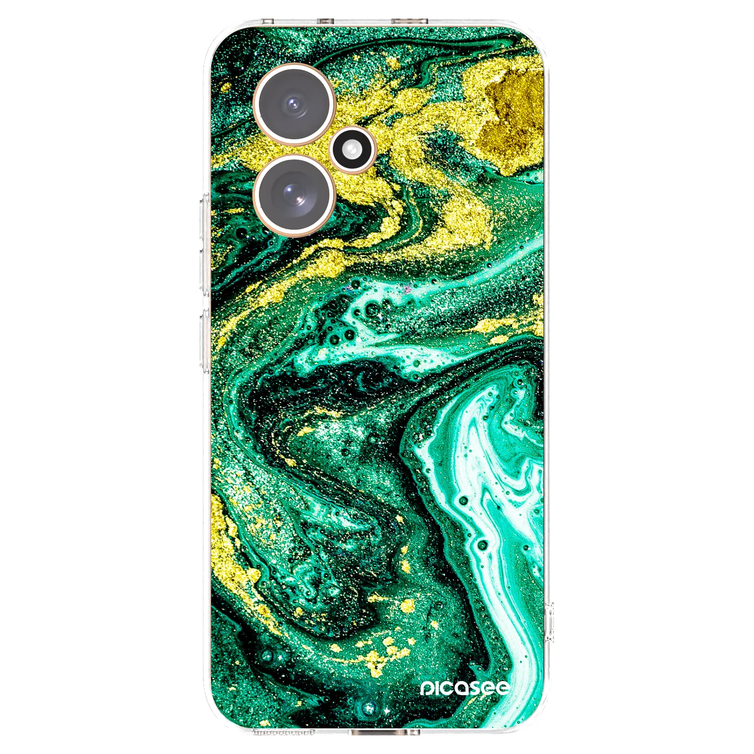 Silikónový prehľadný obal pre Honor 400 5G - Green Gold