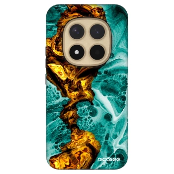 Obal pre Xiaomi Redmi Note 15 Pro+ - Goldsky
