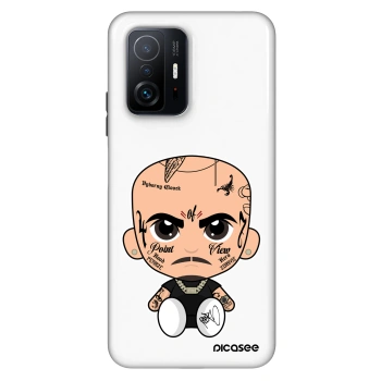 Obal pre Xiaomi 11T - Separ