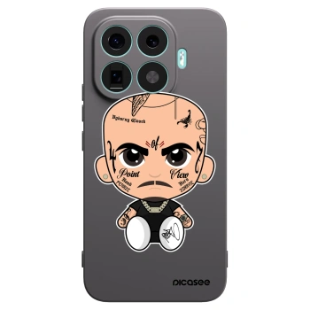 Obal pre Xiaomi 17T Pro - Separ