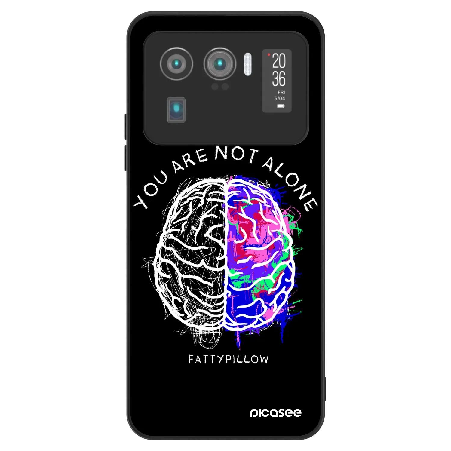 Picasee ULTIMATE CASE pro Xiaomi Mi 11 Ultra - Brain - White