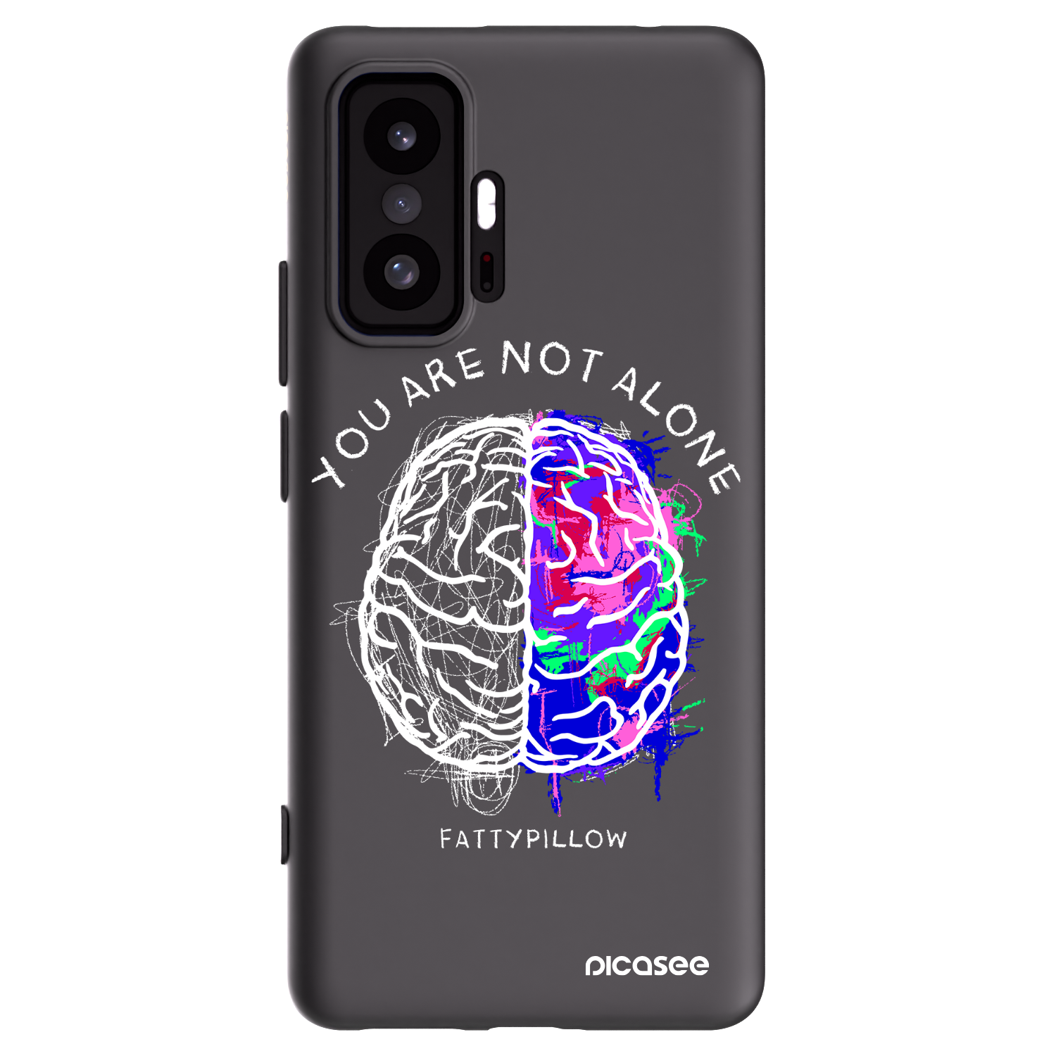 Picasee silikónový čierny obal pre Xiaomi 11T - Brain - White