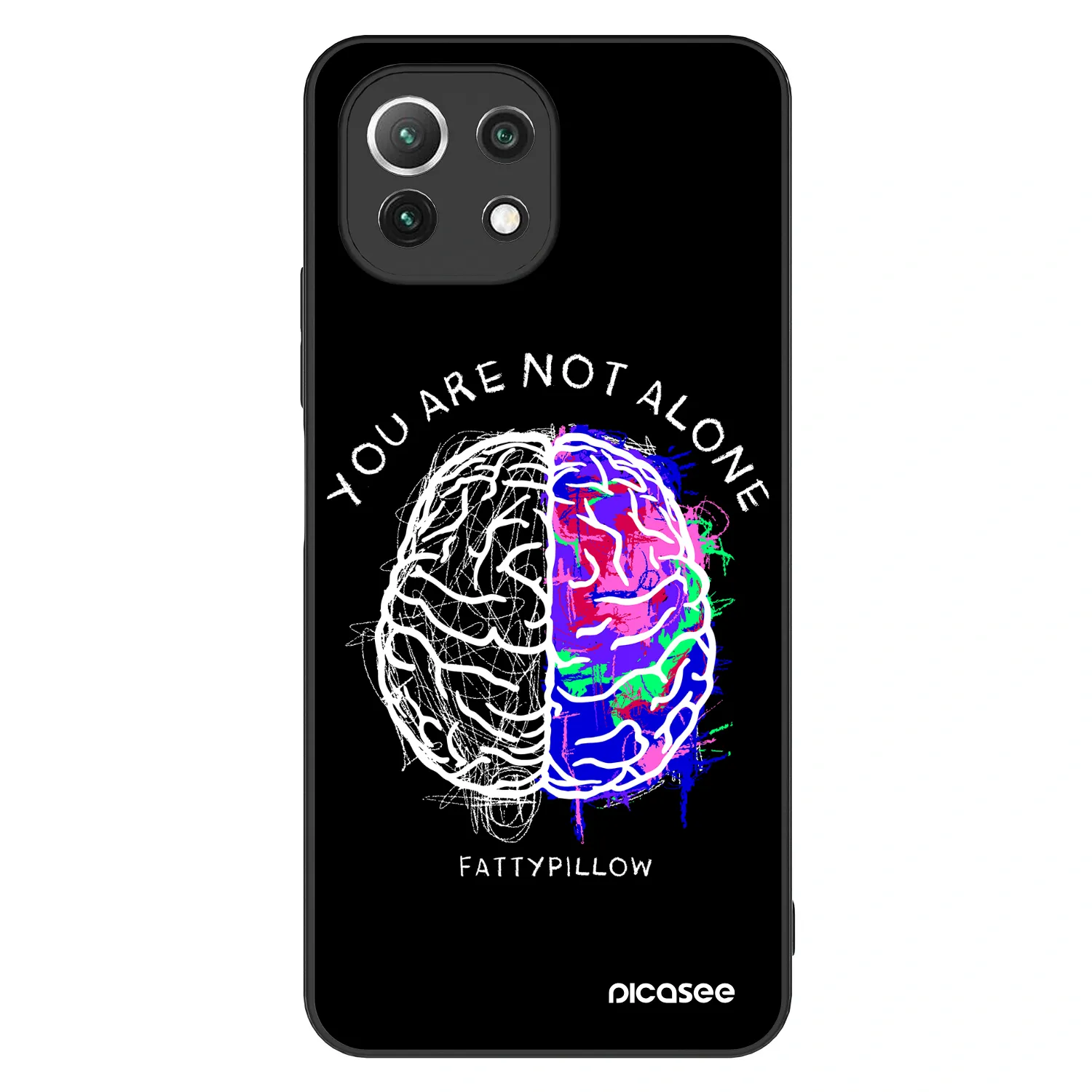 Picasee ULTIMATE CASE pro Xiaomi 11 Lite 5G NE - Brain - White