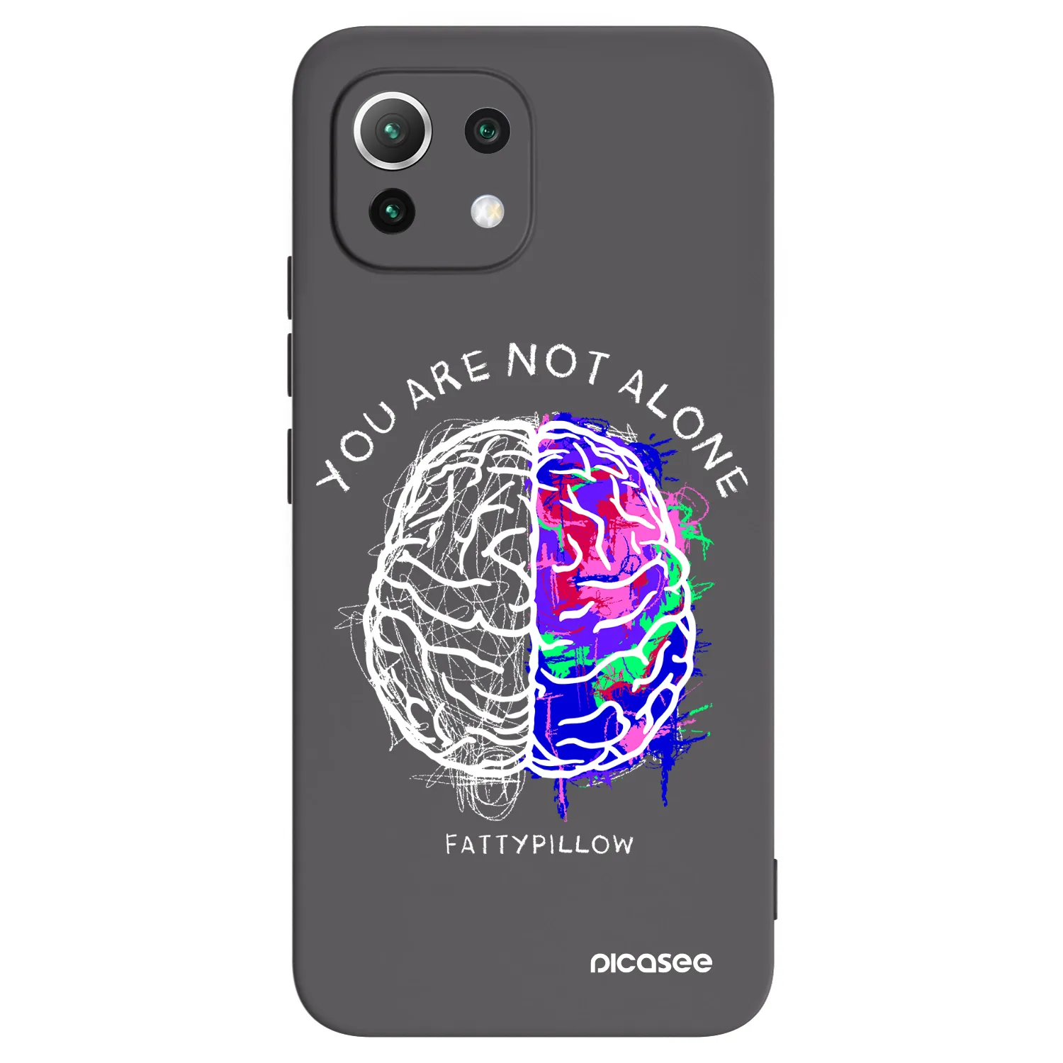 Picasee silikónový čierny obal pre Xiaomi 11 Lite 5G NE - Brain - White