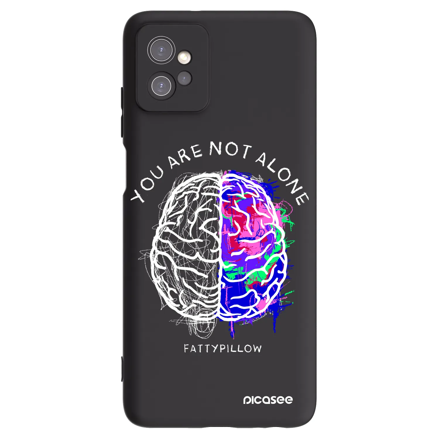 Picasee silikónový čierny obal pre Motorola Moto G32 - Brain - White