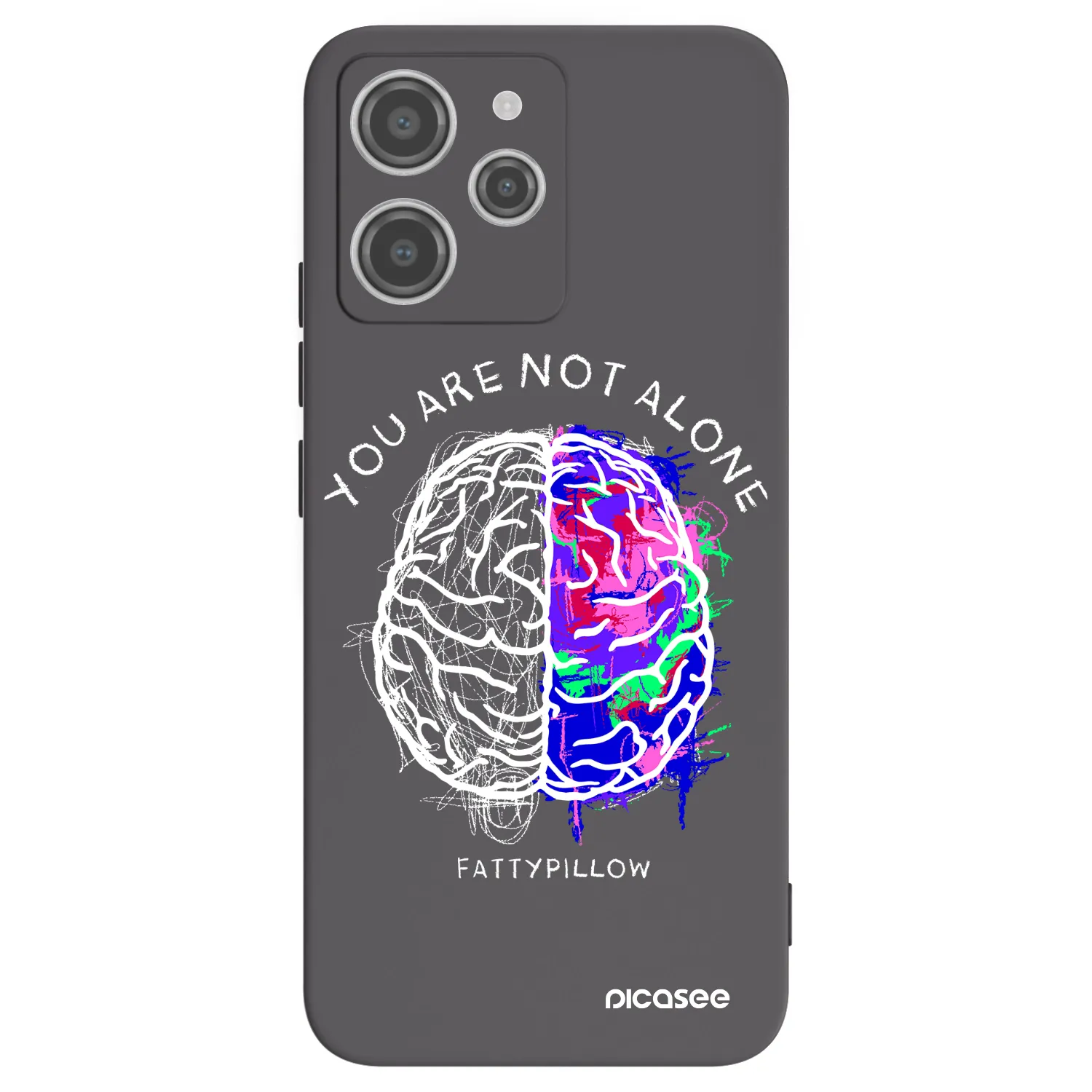 Silikónový čierny obal pre Xiaomi Redmi 12 4G - Brain - White