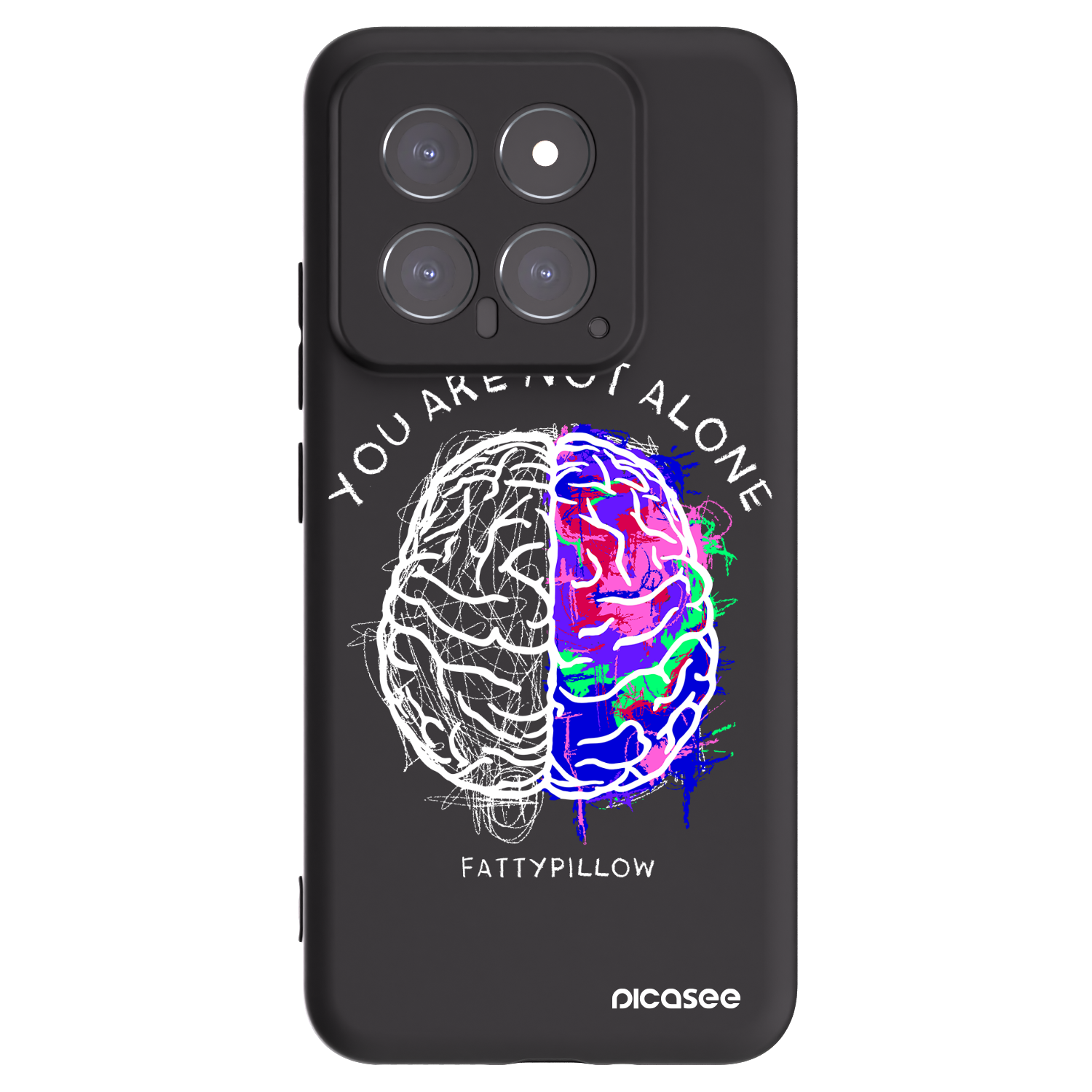 Picasee silikónový čierny obal pre Xiaomi 14 - Brain - White