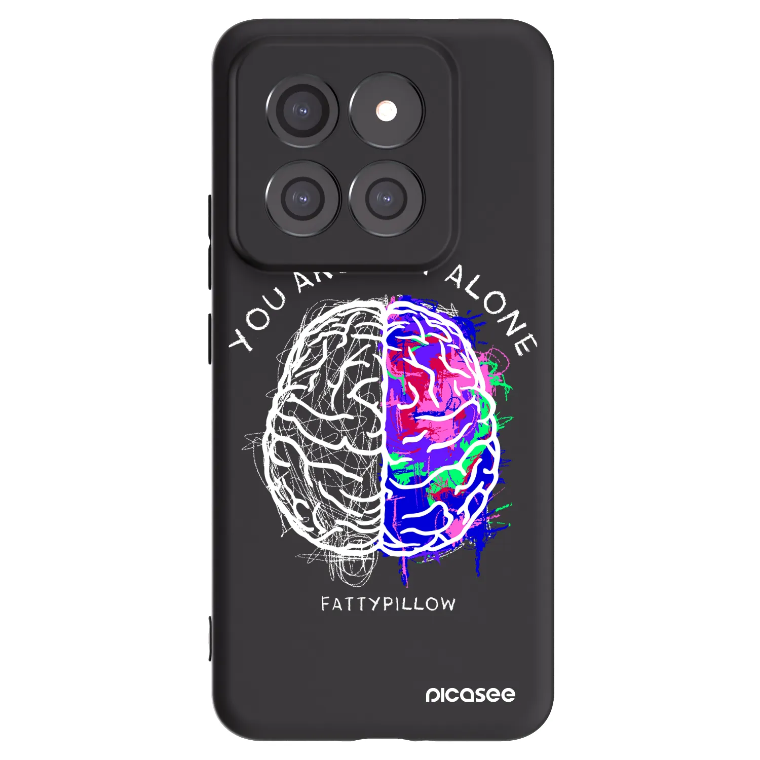 Picasee silikónový čierny obal pre Xiaomi 14 Pro - Brain - White