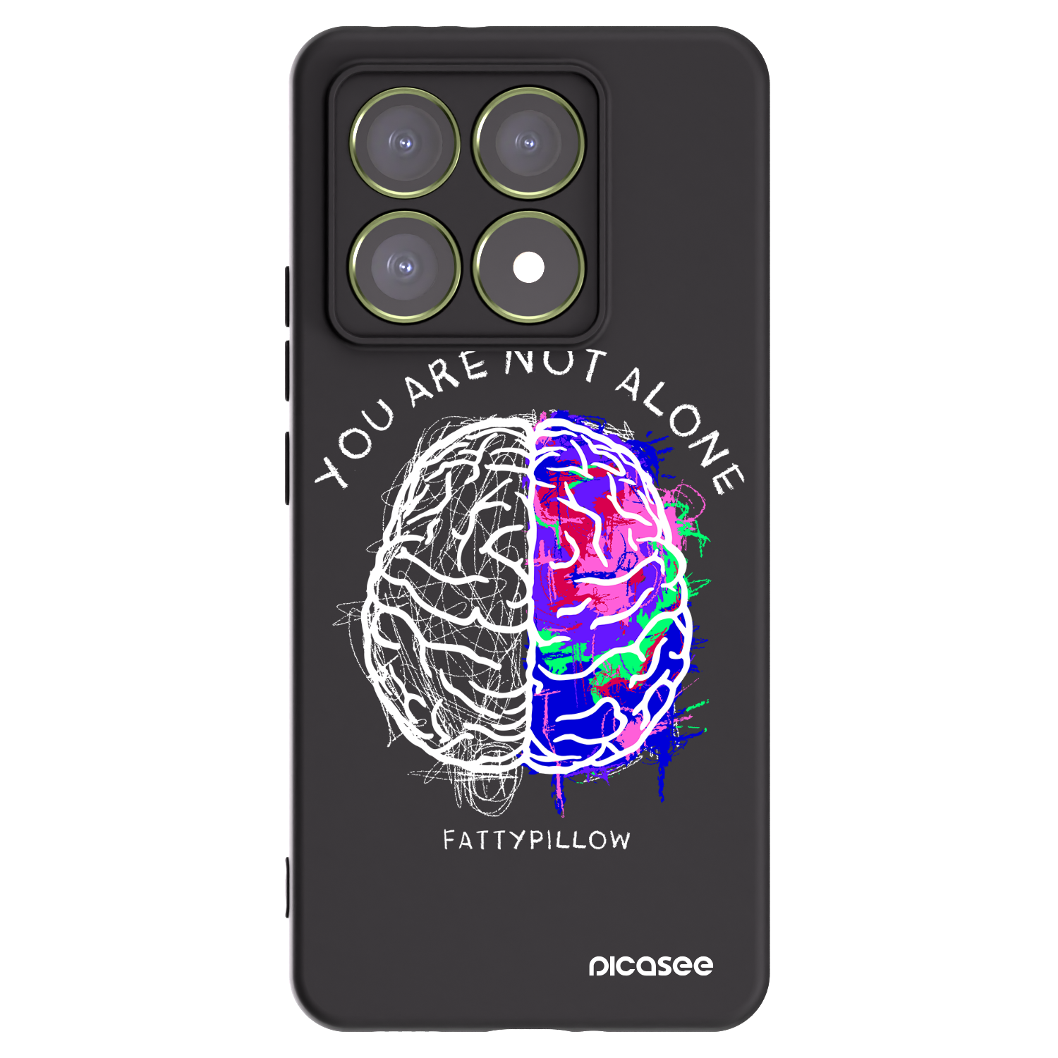 Picasee silikónový čierny obal pre Xiaomi 14T - Brain - White