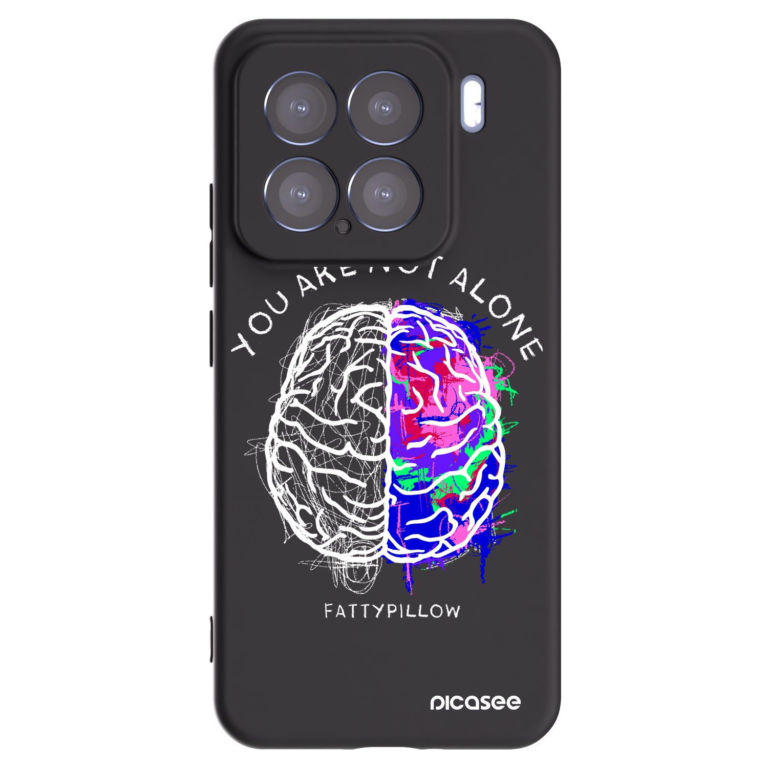 Silikónový čierny obal pre Xiaomi 15 - Brain - White