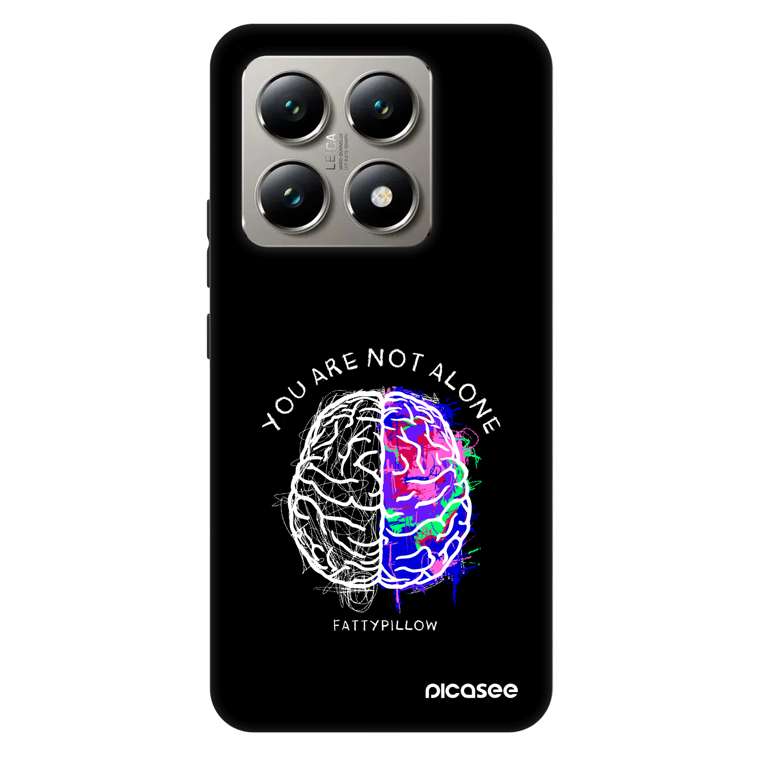 Picasee Fashion Case pre Xiaomi 14T - Brain - White