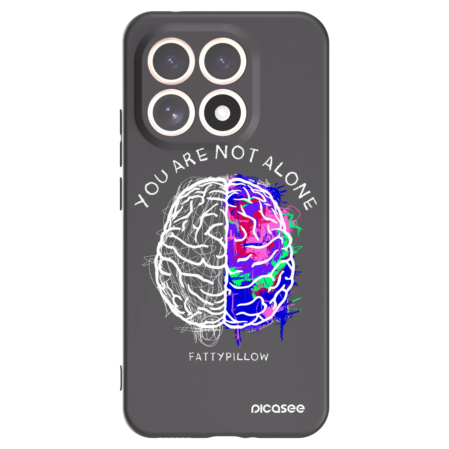 Picasee silikónový čierny obal pre Xiaomi 15T - Brain - White