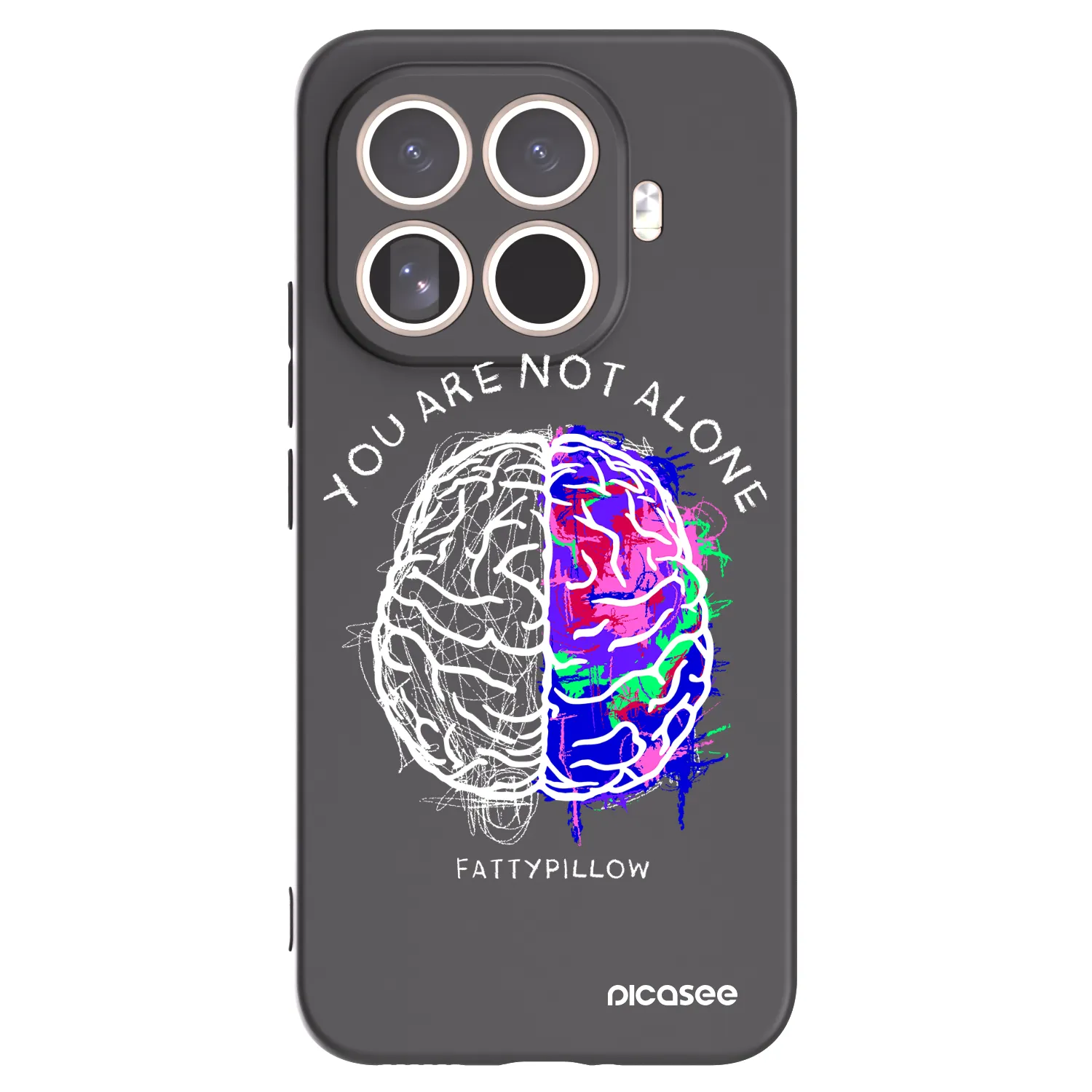 Picasee silikónový čierny obal pre Xiaomi 15T Pro - Brain - White
