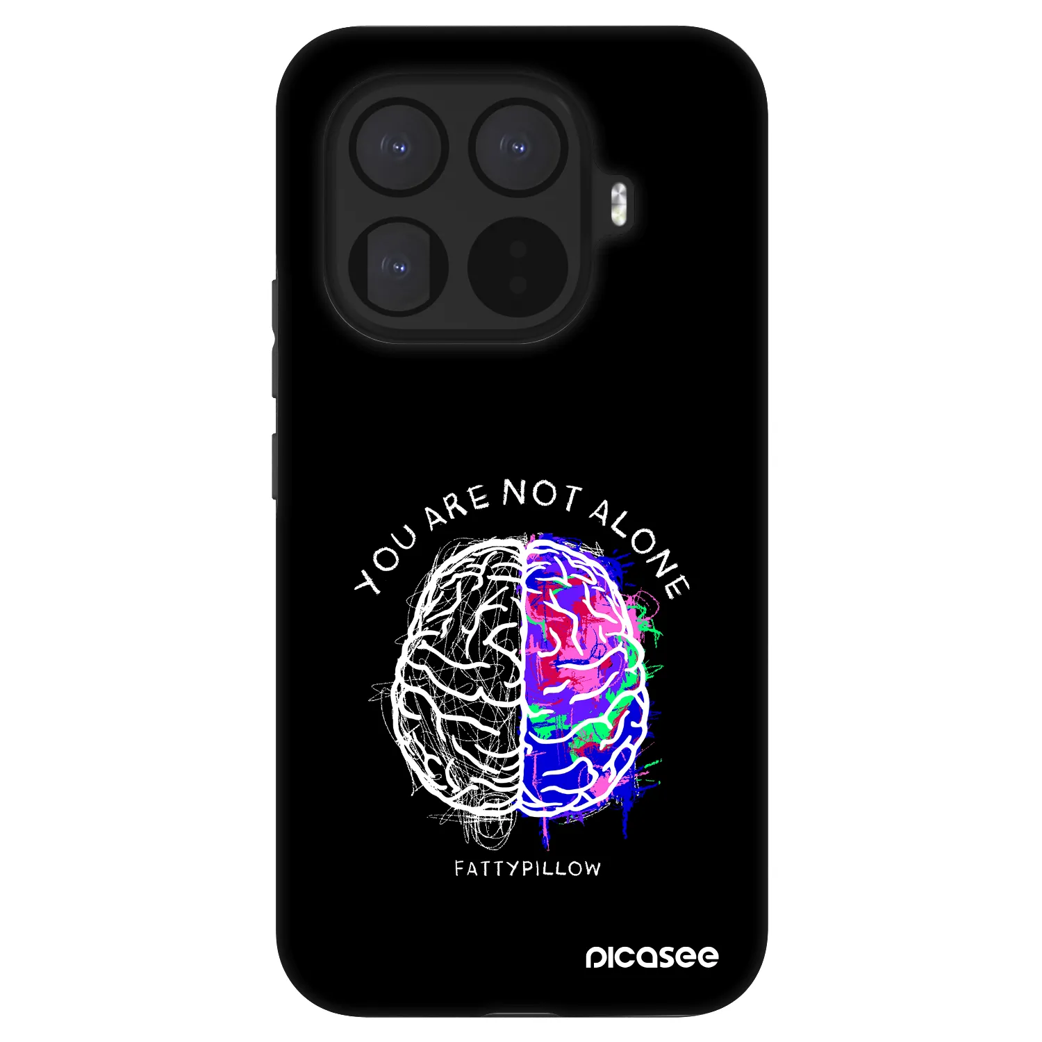 Picasee Fashion Case pre Xiaomi 15T Pro - Brain - White
