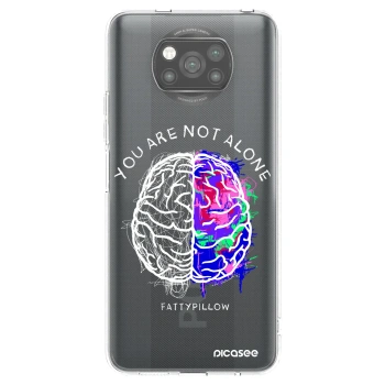 Picasee silikónový čierny obal pre Xiaomi Poco X3 - Brain - White