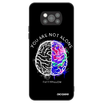 Obal pre Xiaomi Poco X3 Pro - Brain - White