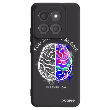 Picasee silikónový čierny obal pre Xiaomi 14 Pro - Brain - White