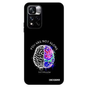 Obal pre Xiaomi Redmi Note 11 Pro - Brain - White
