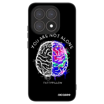 Obal pre Xiaomi 15T - Brain - White