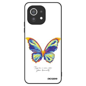 Obal pre Xiaomi Mi 11 - Diamanty White