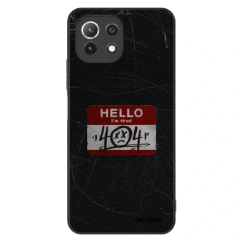 Obal pre Xiaomi 11 Lite 5G NE - HELLO 404