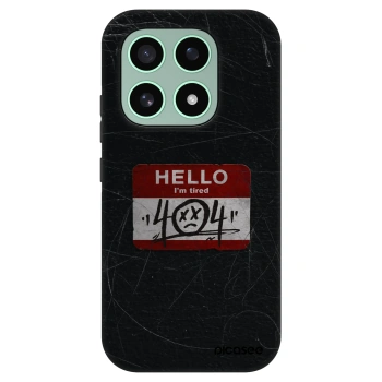 Obal pre Xiaomi 17 - HELLO 404