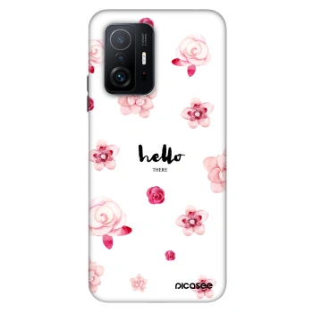 Obal pre Xiaomi 11T - Hello there