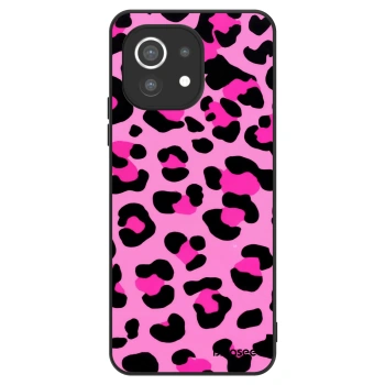 Obal pre Xiaomi Mi 11 - Pink Tiger