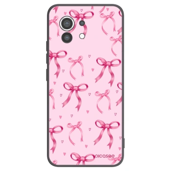 Picasee silikónový čierny obal pre Xiaomi Mi 11 - Bow Aesthetic
