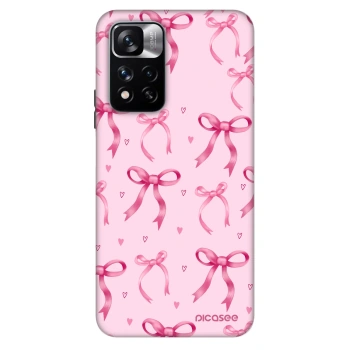 Obal pre Xiaomi Redmi Note 11 Pro - Bow Aesthetic