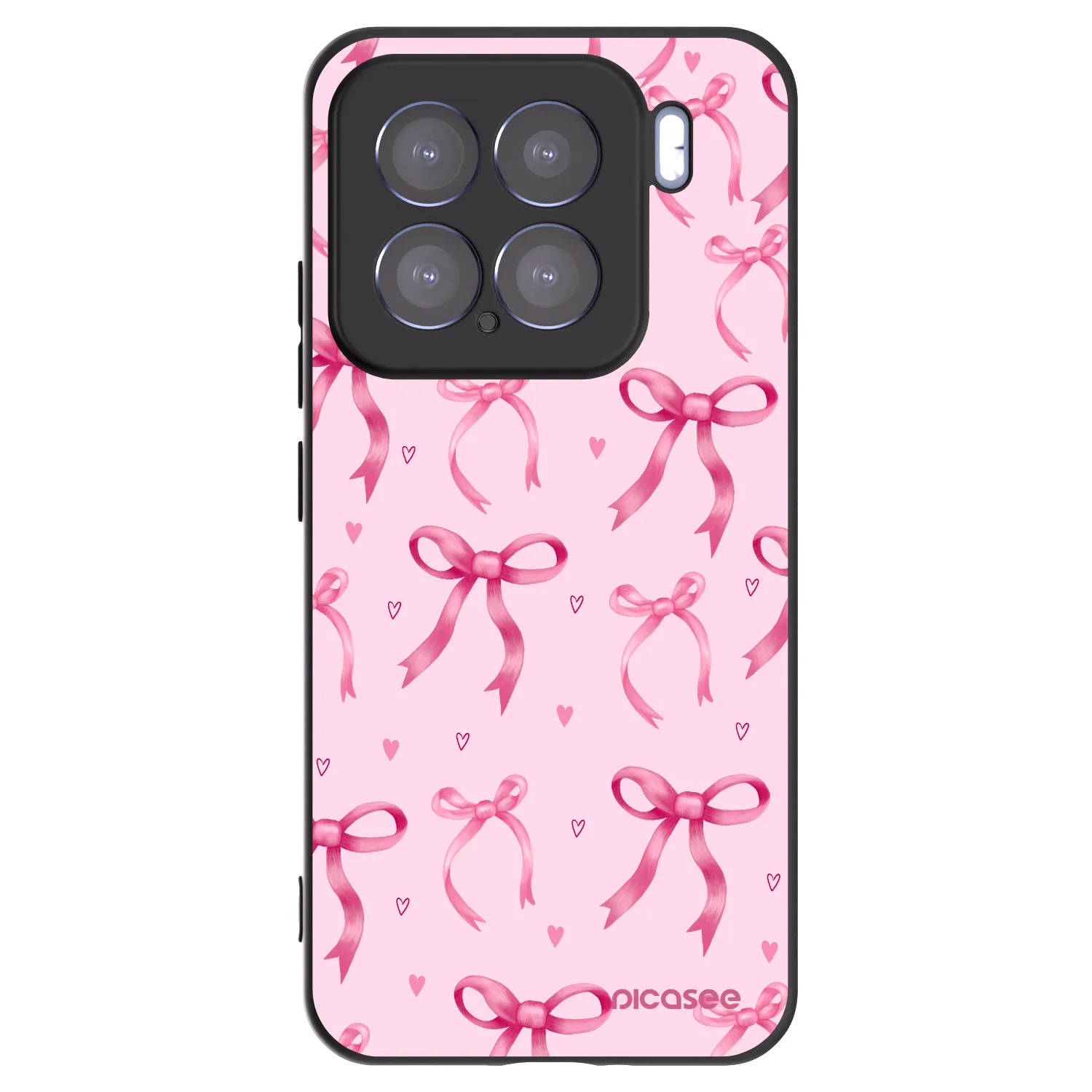 Picasee silikónový čierny obal pre Xiaomi 15 - Bow Aesthetic