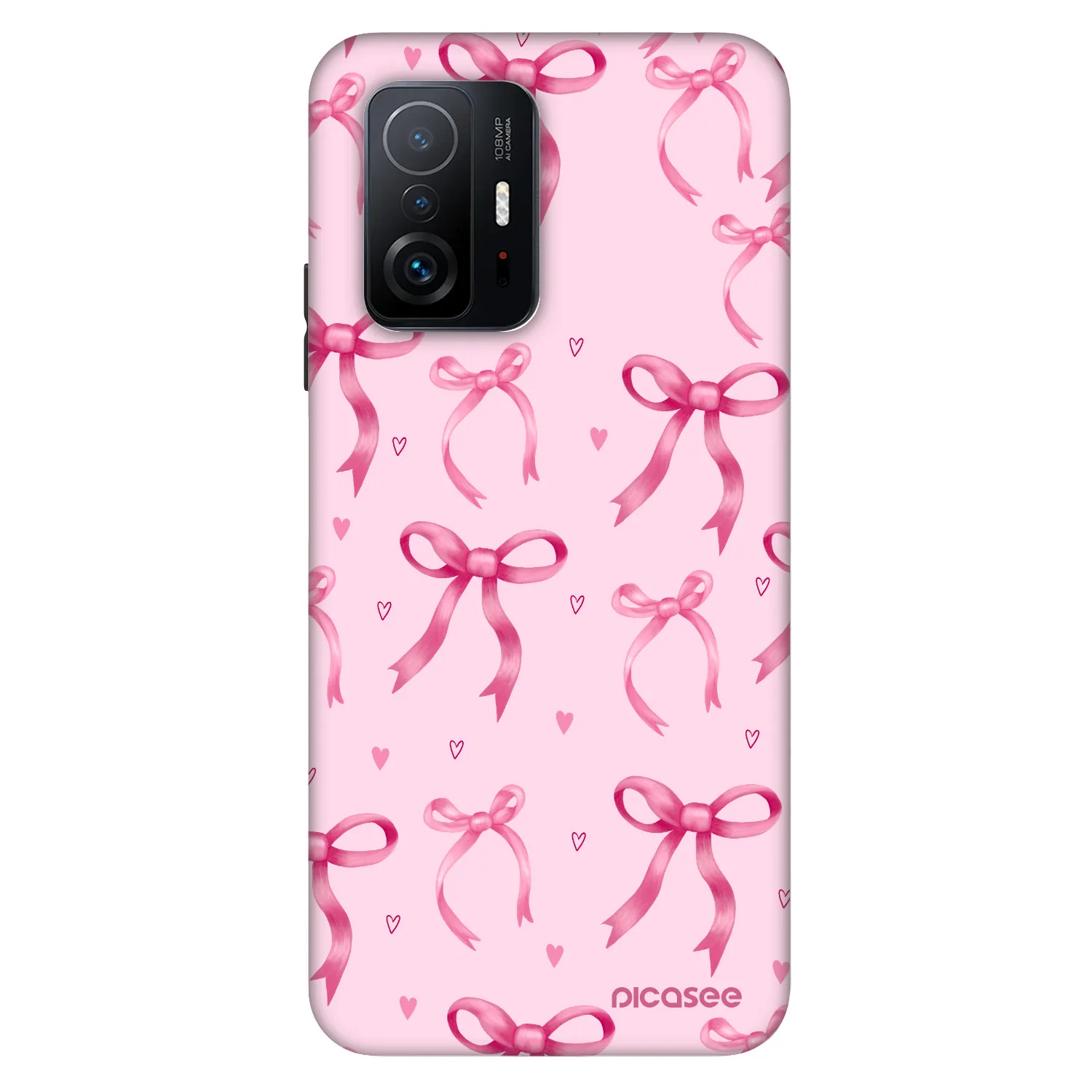 Picasee Fashion Case pre Xiaomi 11T - Bow Aesthetic