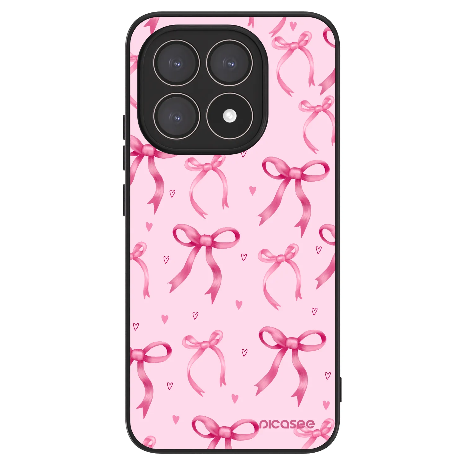 Picasee ULTIMATE CASE pro Xiaomi 15T - Bow Aesthetic