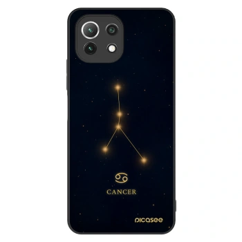 Obal pre Xiaomi 11 Lite 5G NE - CANCER