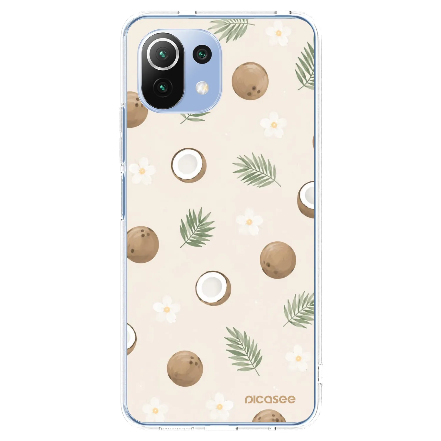 Picasee silikónový prehľadný obal pre Xiaomi Mi 11 Lite - Coconut Breeze