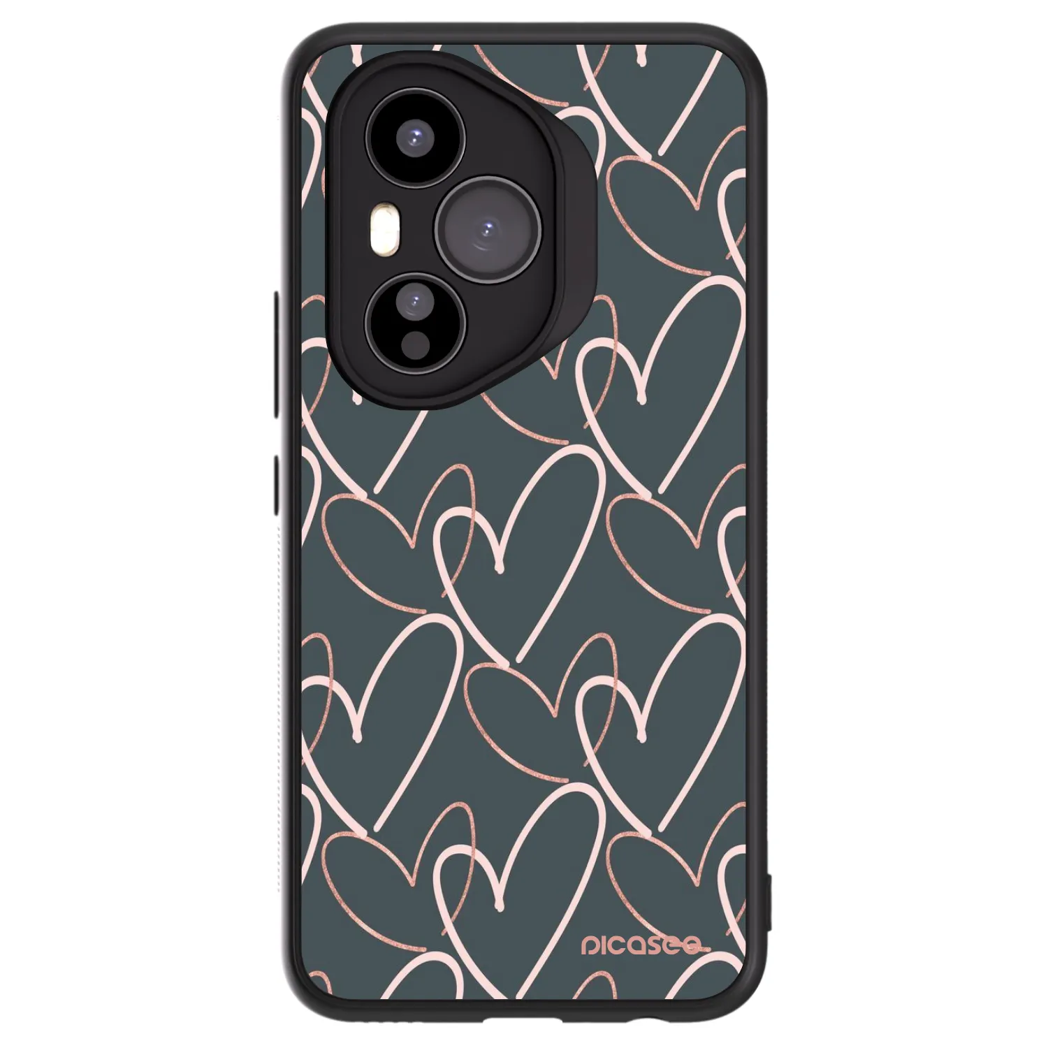 ULTIMATE CASE pro Honor 400 Pro 5G - Veľa lásky