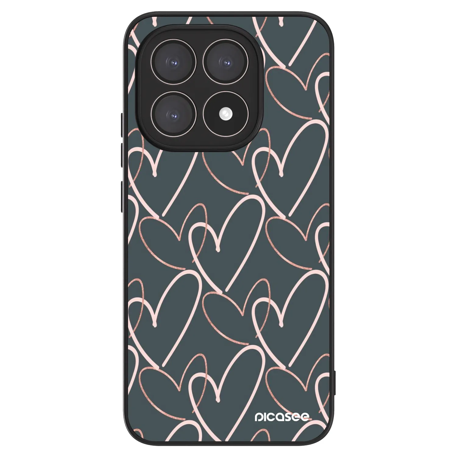 Picasee ULTIMATE CASE pro Xiaomi 15T - Veľa lásky