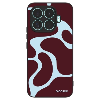 Obal pre Xiaomi 17T Pro - Soft Detour